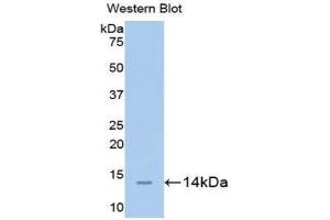 Western Blotting (WB) image for anti-Carcinoembryonic Antigen-Related Cell Adhesion Molecule 1 (CEACAM1) (AA 35-143) antibody (ABIN1175886) (CEACAM1 antibody  (AA 35-143))