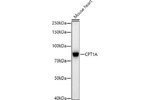 Western blot analysis of extracts of Mouse heart, using CPT1A antibody (ABIN7266089) at 1:1000 dilution. (CPT1A antibody  (AA 497-756))
