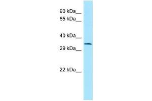 WB Suggested Anti-Atf5 Antibody Titration: 1. (ATF5 antibody  (C-Term))