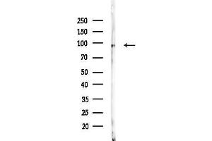 anti-Helicase, Lymphoid-Specific (HELLS) (Internal Region) antibody