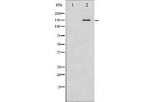 Western blot analysis of Bcr phosphorylation expression in COS7 whole cell lysates,The lane on the left is treated with the antigen-specific peptide. (BCR antibody  (pTyr360))