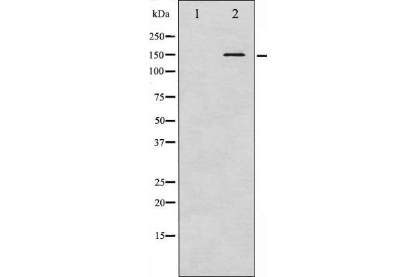 BCR anticorps  (pTyr360)