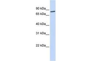 Image no. 1 for anti-Aconitase 2, Mitochondrial (ACO2) (AA 108-157) antibody (ABIN6743266) (ACO2 antibody  (AA 108-157))