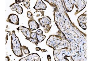 IHC analysis of KIF2A using anti-KIF2A antibody (ABIN7600510). (KIF2A antibody  (AA 2-706))