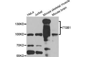 Western blot analysis of extracts of various cell lines, using ITGB1 antibody (ABIN6003513) at 1/1000 dilution. (ITGB1 antibody)