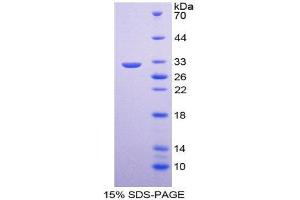 SDS-PAGE (SDS) image for Collagen, Type IV, alpha 5 (COL4A5) (AA 1461-1685) protein (His tag) (ABIN1098974)