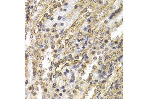 Immunohistochemistry (IHC) image for anti-Neural Precursor Cell Expressed, Developmentally Down-Regulated 9 (NEDD9) (AA 60-174) antibody (ABIN3023331) (NEDD9 antibody  (AA 60-174))
