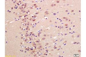 Formalin-fixed and paraffin embedded rat brain labeled with Anti-Neuritin Polyclonal Antibody, Unconjugated (ABIN740655) at 1:200 followed by conjugation to the secondary antibody and DAB staining