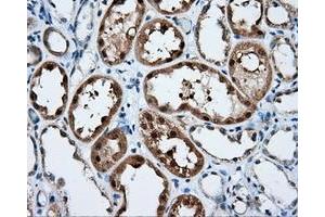 Immunohistochemical staining of paraffin-embedded liver tissue using anti-SIL1 mouse monoclonal antibody. (SIL1 antibody)