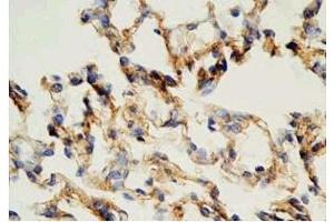 Rat lung tissue was stained by Rabbit Anti-AdrenomeduIIiln (1-44) (Human) Antibody (Adrenomedullin antibody  (AA 1-44))