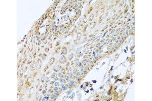 Immunohistochemistry of paraffin-embedded Human esophagus using NDUFA2 Polyclonal Antibody at dilution of 1:100 (40x lens). (NDUFA2 antibody)