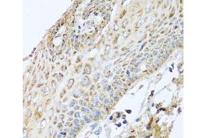 Immunohistochemistry of paraffin-embedded Human esophagus using NDUFA2 Polyclonal Antibody at dilution of 1:100 (40x lens).