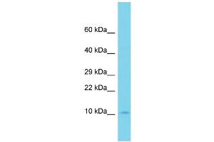 Western Blotting (WB) image for anti-Ubiquitin-Conjugating Enzyme E2D 4 (UBE2D4) (C-Term) antibody (ABIN2791098) (UBE2D4 antibody  (C-Term))