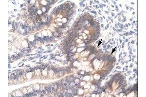 Image no. 1 for anti-FOS-Like Antigen 2 (FOSL2) (AA 208-256) antibody (ABIN6735784) (FOSL2 antibody  (AA 208-256))
