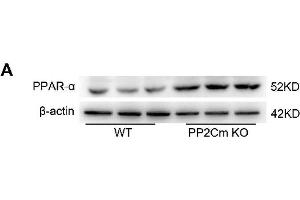 Exacerbated I/R injury in the PP2Cm KO heart is rescued by PPAR-α knockdown. (PPARA antibody  (AA 1-230))
