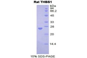 SDS-PAGE (SDS) image for Thrombospondin 1 (THBS1) (AA 71-259) protein (His tag) (ABIN1878230) (Thrombospondin 1 Protein (THBS1) (AA 71-259) (His tag))