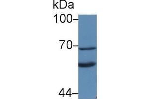 Detection of KL in Rat Liver lysate using Polyclonal Antibody to Klotho (KL) (Klotho antibody  (AA 517-956))