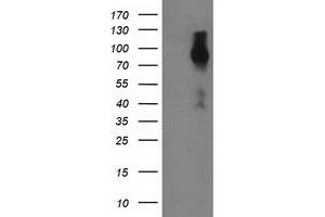 HEK293T cells were transfected with the pCMV6-ENTRY control (Left lane) or pCMV6-ENTRY FGFR2 (Right lane) cDNA for 48 hrs and lysed. (FGFR2 antibody)