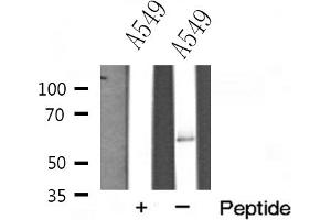 Western blot analysis of FAST kinase expression in A549 cells (FASTK antibody  (Internal Region))