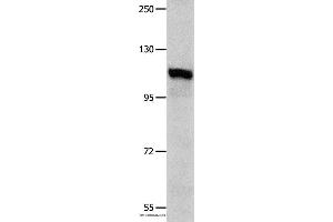 Western blot analysis of K652 cell , using IDE Polyclonal Antibody at dilution of 1:350 (IDE antibody)