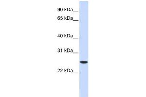 WB Suggested Anti-UBE2K Antibody Titration: 0.