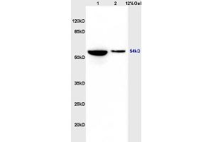Lane 1: rat heart lysates Lane 2: rat brain lysates probed with Anti phospho-GSK3 Alpha(Ser21) Polyclonal Antibody, Unconjugated (ABIN708116) at 1:200 in 4 °C. (GSK3 alpha antibody  (pSer21))