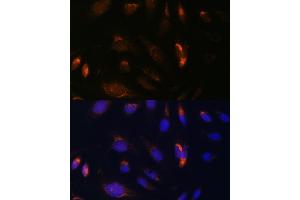 Immunofluorescence analysis of U-2 OS cells using CHUK antibody (ABIN3022824, ABIN3022825, ABIN3022826 and ABIN6219246) at dilution of 1:100.