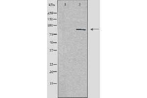Western blot analysis of extracts from HepG2 cells, using ZNF148 antibody. (ZNF148 antibody  (N-Term))
