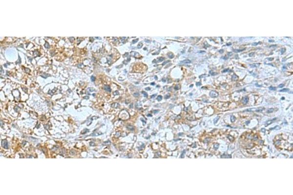 TSGA10 antibody