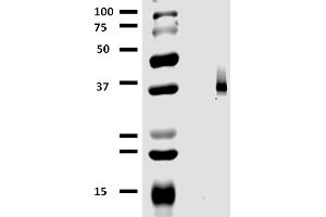 Western blotting analysis (non-reducing conditions) of whole cell lysate of MCF-7 human breast adenocarcinoma cell line using anti-CD326 / EpCAM (323/A3).