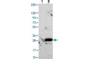 Western blot analysis of Lane 1: Negative control (vector only transfected HEK293T lysate). (RCL antibody)