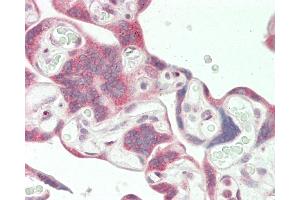 Immunohistochemistry (Paraffin-embedded Sections) (IHC (p)) image for anti-MORC Family CW-Type Zinc Finger 3 (MORC3) (AA 634-663) antibody (ABIN1881548)