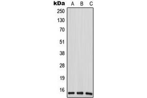 Western blot analysis of ANP32D expression in HeLa (A), mouse liver (B), rat liver (C) whole cell lysates. (ANP32D antibody  (N-Term))