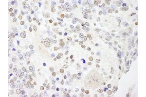 Immunohistochemistry (IHC) image for anti-Ankyrin Repeat and SAM Domain-Containing Protein 3 (ANKS3) (AA 606-656) antibody (ABIN7448411) (ANKS3 antibody  (AA 606-656))