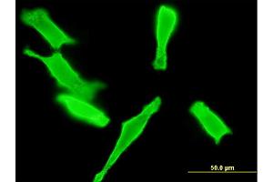 Immunofluorescence of monoclonal antibody to GUCY2D on HeLa cell. (GUCY2D antibody  (AA 521-630))