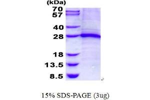 Image no. 1 for Slow Skeletal Troponin I (TNNI1) protein (His tag) (ABIN1098698)