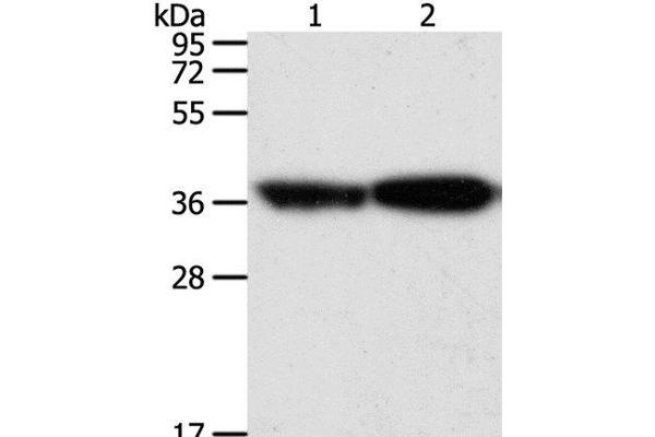 TPM2 antibody