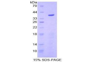 SDS-PAGE (SDS) image for Apolipoprotein C-I (APOC1) (AA 32-88) protein (His tag,GST tag) (ABIN2122431)