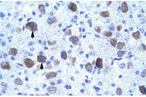 Immunohistochemical staining (Formalin-fixed paraffin-embedded sections) of human brain with KCNIP4 polyclonal antibody . (KCNIP4 antibody  (AA 27-76))