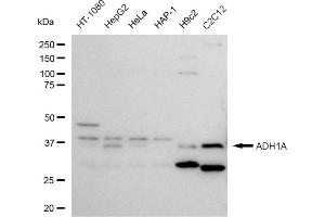 Western blotting analysis using ADH1A antibody (ABIN7797550).