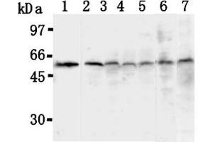 Western Blotting (WB) image for anti-Thioredoxin Interacting Protein (TXNIP) antibody (ABIN567793) (TXNIP antibody)