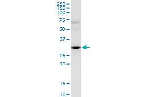 HEY2 monoclonal antibody (M02), clone 2B10. (HEY2 antibody  (AA 1-110))