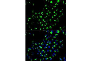 Immunofluorescence analysis of A549 cell using AK4 antibody. (AK4 antibody)