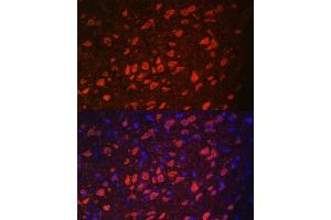 Immunofluorescence analysis of rat brain using TRPM2 antibody (ABIN6128836, ABIN6149582, ABIN6149583 and ABIN6221738) at dilution of 1:100. (TRPM2 antibody  (AA 900-1000))