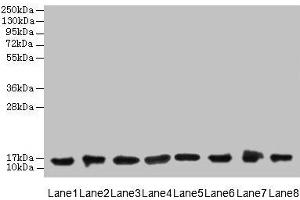 Western blot All lanes: COTL1 antibody at 8 μg/mL Lane 1: Mouse brain tissue Lane 2: Hela whole cell lysate Lane 3: Mouse kidney tissue Lane 4: HepG2 whole cell lysate Lane 5: Mouse thymus tissue Lane 6: U87 whole cell lysate Lane 7: HL60 whole cell lysate Lane 8: A549 whole cell lysate Secondary Goat polyclonal to rabbit IgG at 1/10000 dilution Predicted band size: 16 kDa Observed band size: 16 kDa (COTL1 antibody  (AA 2-142))
