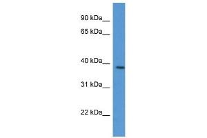 Western Blot showing VASP antibody used at a concentration of 1 ug/ml against Jurkat Cell Lysate (VASP antibody  (C-Term))