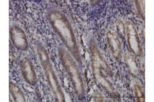 Immunoperoxidase of monoclonal antibody to DHODH on formalin-fixed paraffin-embedded human stomach. (DHODH antibody  (AA 32-140))