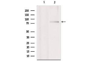 Western blot analysis of extracts from various samples, using RNF6 Antibody. (RNF6 antibody  (Internal Region))