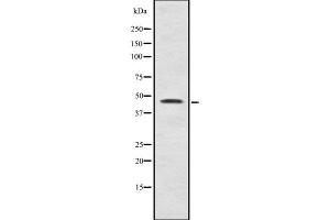 Western blot analysis Sox-11 using LOVO whole cell lysates