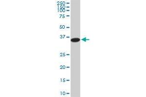 PGGT1B antibody  (AA 1-105)